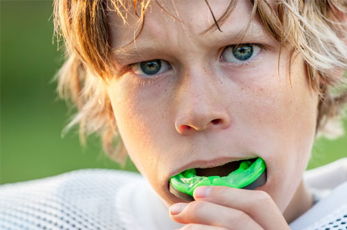 Safe Seasons Start with Mouthguards